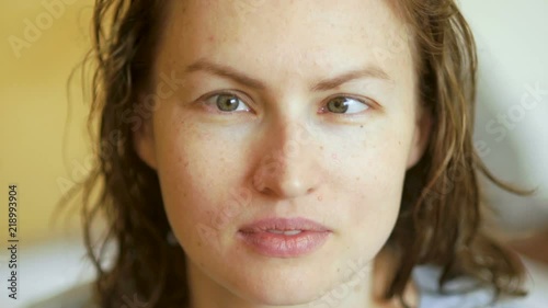 A large portrait of a young woman with a vision problem, strabismus, nearsightedness. Symptoms of ophthalmic diseases