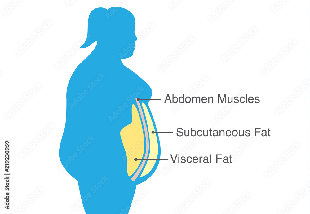 Visceral fat and subcutaneous fat that accumulate around waistline of