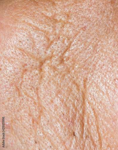 wrinkles skin old man macro