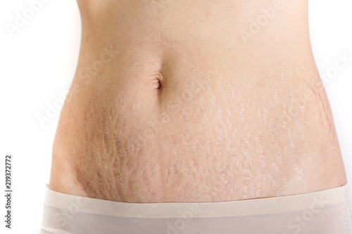 Abdominal scar marked pattern
