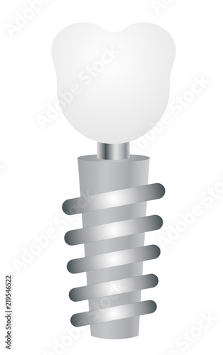 tooth implant on a white background vector eps 10