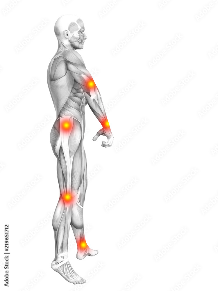 Conceptual human muscle anatomy with red and yellow hot spot inflammation or articular joint pain for health care therapy or sport concepts. 3D illustration man arthritis or bone osteoporosis disease Conceptual human muscle anatomy with red and yellow hot spot inflammation or articular joint pain for health care therapy or sport concepts. 3D illustration man arthritis or bone osteoporosis disease