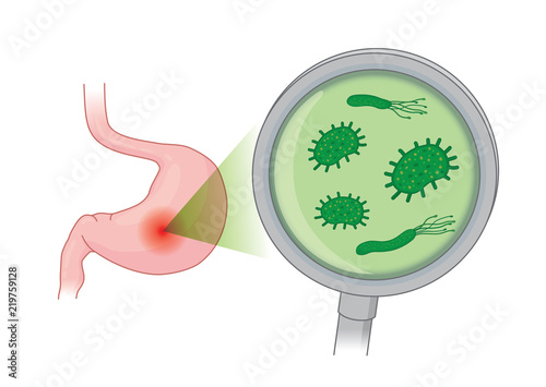 Looking Bacterial in human stomach with with Magnifying glass. Concept illustration about health care and medical.