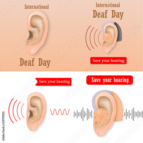 International Deaf Day hear world banner concept set. Realistic illustration of 4 International Deaf Day hear world vector banner concepts for web