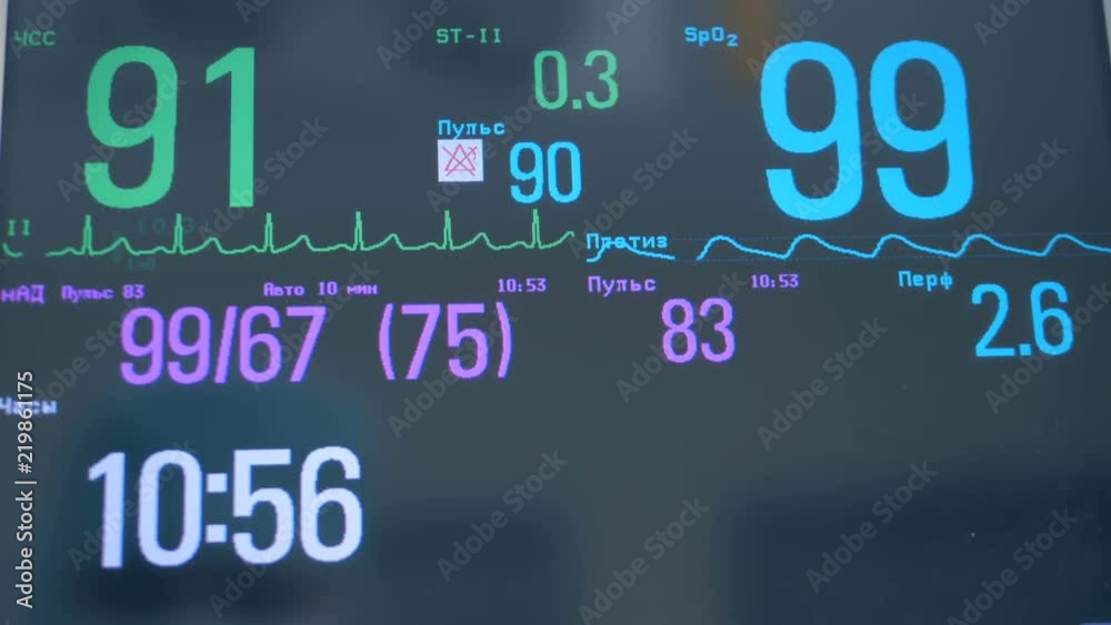 Person's heart rate on a monitor, close up. Person's heart rate on a monitor, close up.