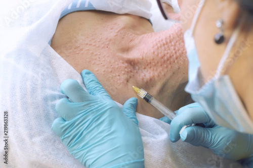 The cosmetologist injects the patient into the neck. first person view. closeup photo