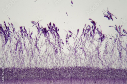 Bild auf Leinwand Microscope photo a bundle of Penicillium fungi