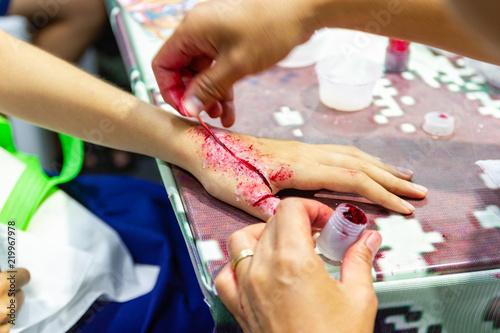 The fake wound on the hand for the boy, Dress the wound special effect by professional