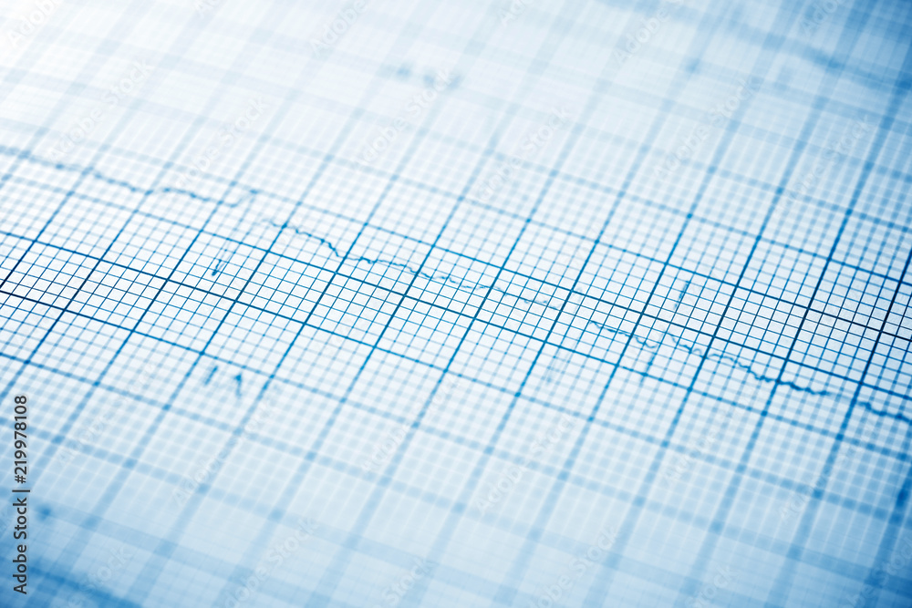 Electrocardiogram close up Electrocardiogram close up