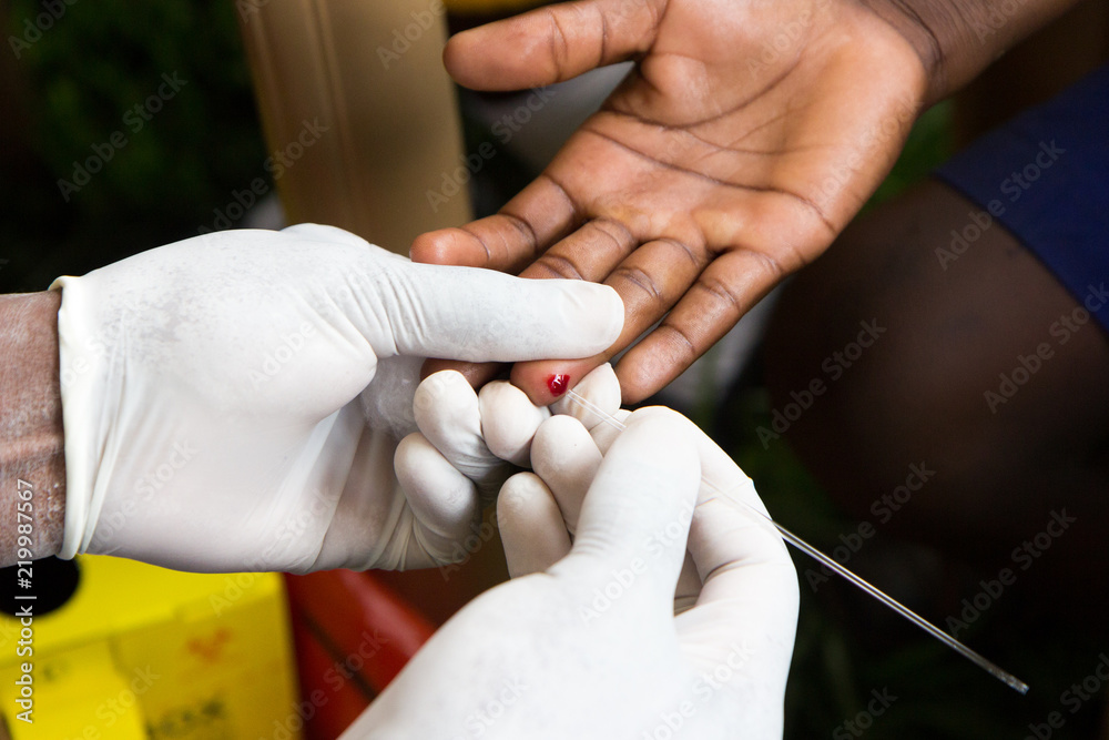 a health worker doing a finger prick test for HIV. He is drawing blood