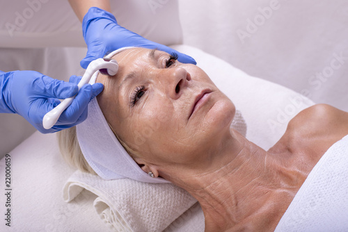 Portrait of senior woman during anti aging treatment with dermaroller photo