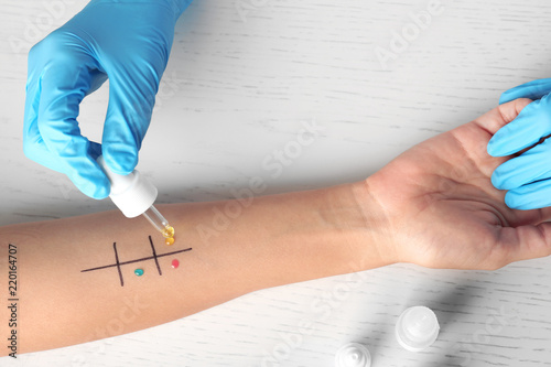 Doctor making allergy test at table, top view photo