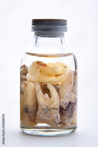 Concept - dentist's trophy. Set of removed teeth in a glass medical vial with ethyl alcohol. Macro photography