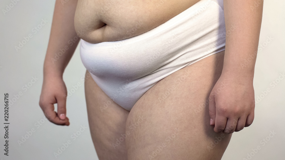 Closeup of saggy belly and hips of overweight woman, plump female, healthcare