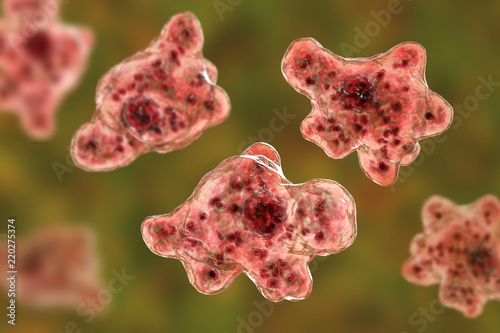 Brain-eating amoeba infection, naegleriasis
