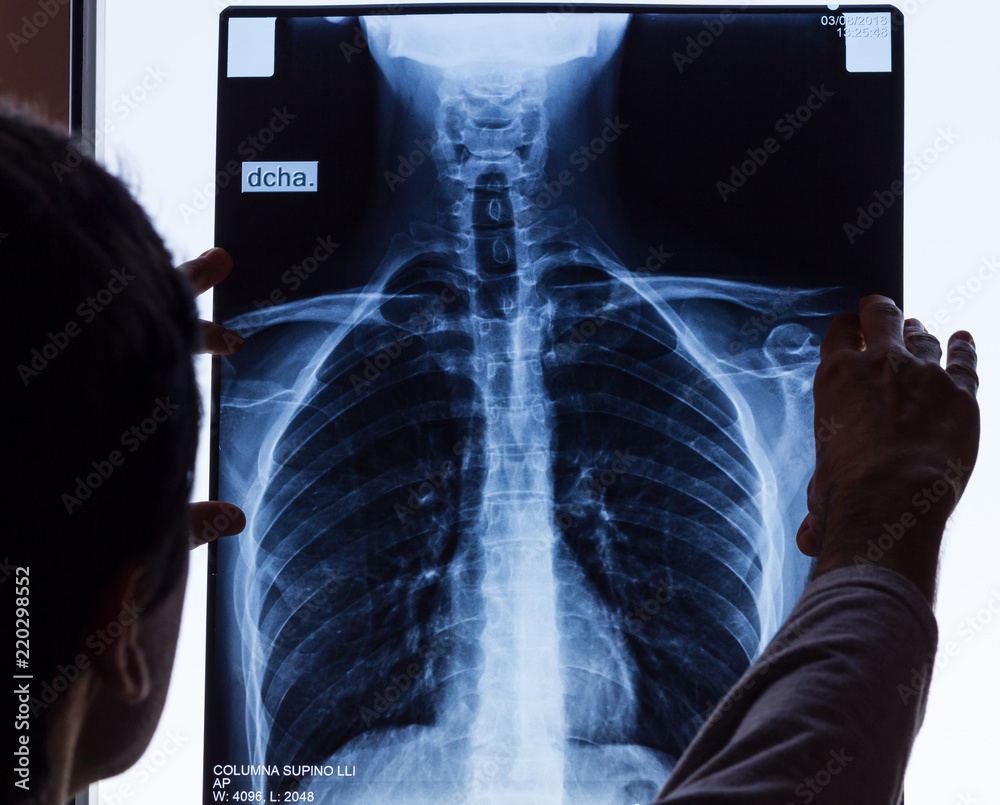Doctor checking on chest X-ray. Man holding radiography looking at it.  Spinal column exam, anatomy, science, profession, work, patient accident  concepts. Language translation: right Photos