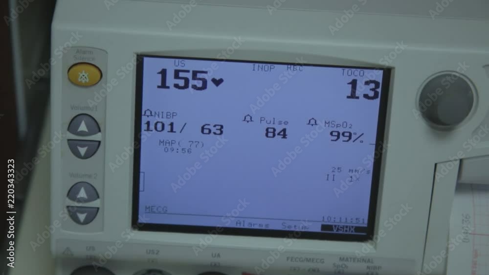 Shots of Medical equipment used for pregnancy. Shots of Medical equipment used for pregnancy.