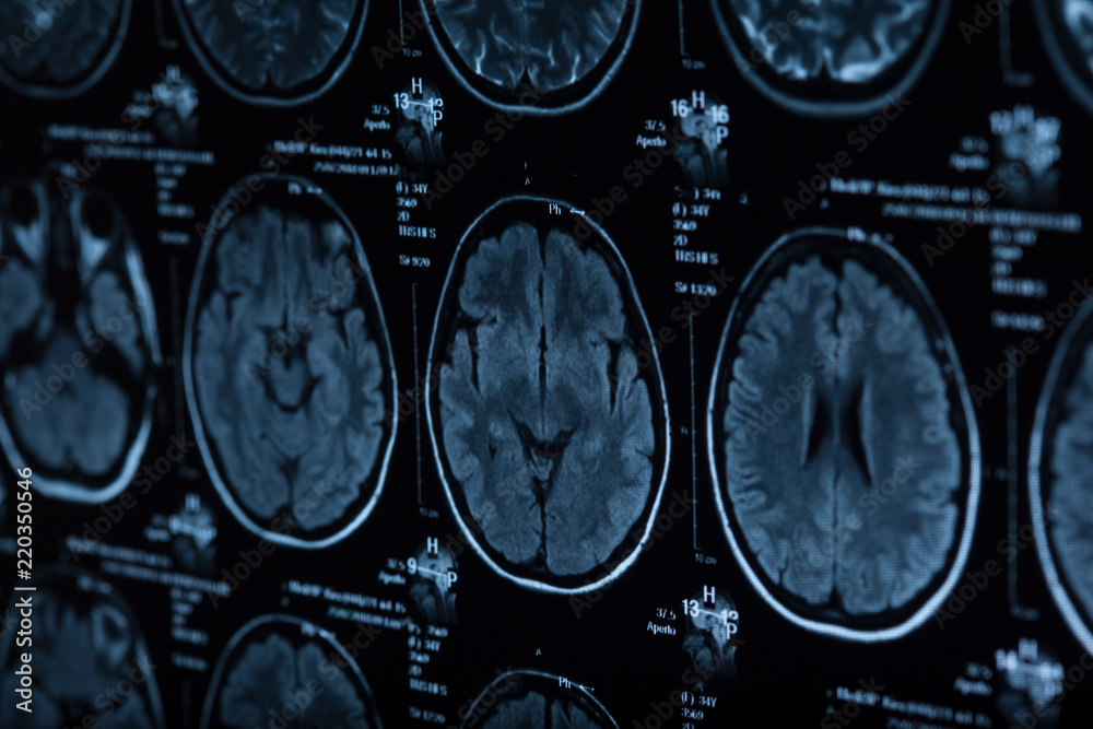 The X-ray of the human brain