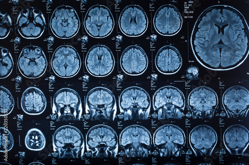 The X-ray of the human brain © merydolla