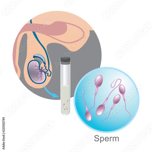 In vitro fertilization, Sperm Illustration.