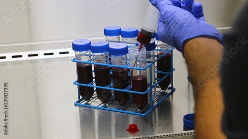 POV Transferring Real Blood into Conical Centrifuge Tubes Under a Sterile Hood in a Lab - PRP and Stem Cell Process photo