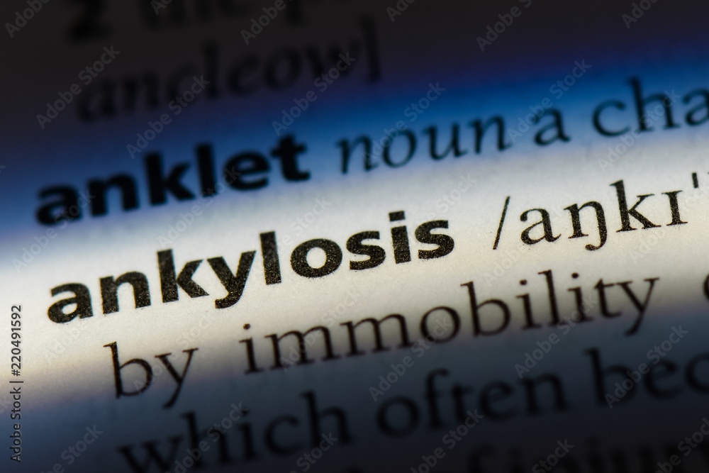 Obraz premium ankylosis