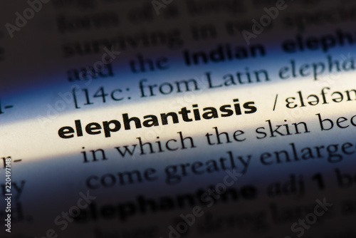  elephantiasis photo
