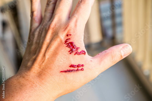 Focus dog bite wound and blood on hand. Infection and Rabies concept. Pet care and rabies prevention concept. Accidental and first aid concept. image for background, objects, copy space. photo