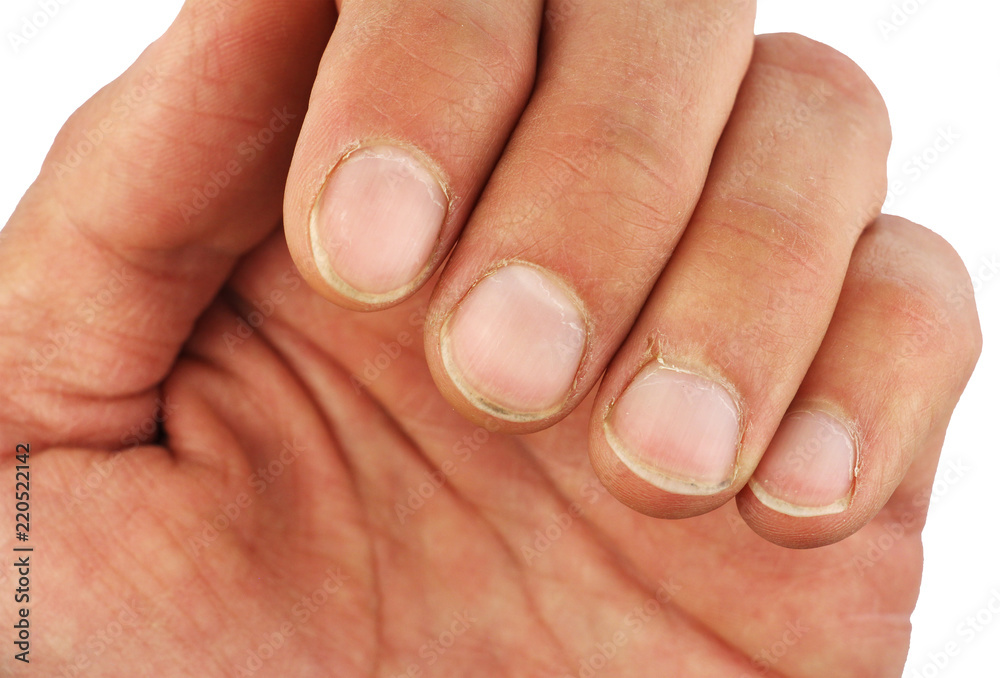 male left hand fingers with dirt under the nails, closeup macro, isolated male left hand fingers with dirt under the nails, closeup macro, isolated