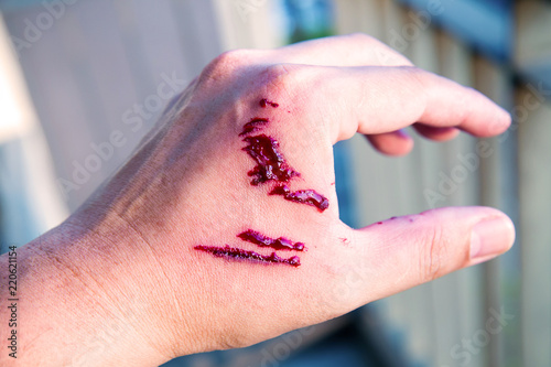 Obraz na plátne Focus dog bite wound and blood on hand