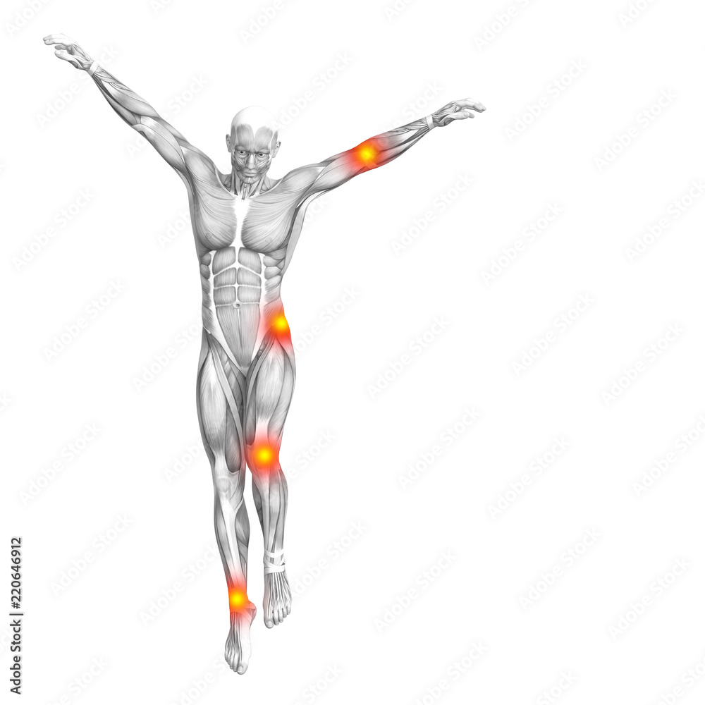 Conceptual human muscle anatomy with red and yellow hot spot inflammation or articular joint pain for health care therapy or sport concepts. 3D illustration man arthritis or bone osteoporosis disease Conceptual human muscle anatomy with red and yellow hot spot inflammation or articular joint pain for health care therapy or sport concepts. 3D illustration man arthritis or bone osteoporosis disease