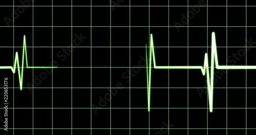 ECG, electrocardiogram showing a heart rate, diagnostic device in hospital, heart beat, medical check-up, vital signs data screen, life, artwork in medicine, green sound wave on black, 4k loop photo