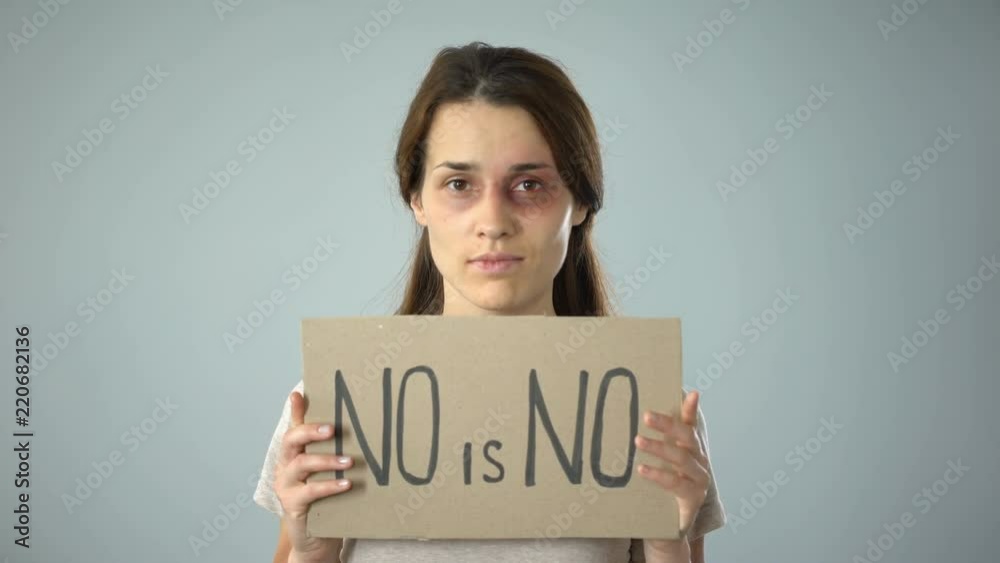 Bruised female holding no is no sign, putting end to violence against women Bruised female holding no is no sign, putting end to violence against women