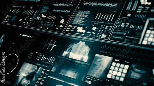 Futuristic patient monitor screen in perspective / Medical screen interface. Screen with various parameters measured. ST-segment and heart attack detection, pace-maker analysis, and arrhythmia analysi