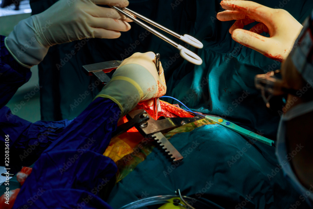 Teamwork surgeons during in the surgical operating room with coronary artery disease