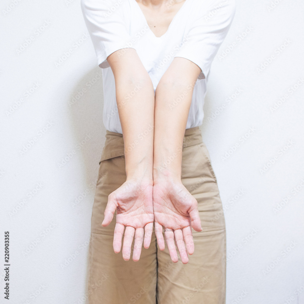猿腕 猿手 のカジュアルな服の女性 2 Stock Photo Adobe Stock