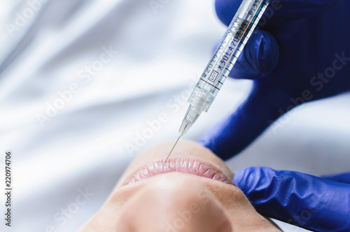 Woman having lip fillers done photo