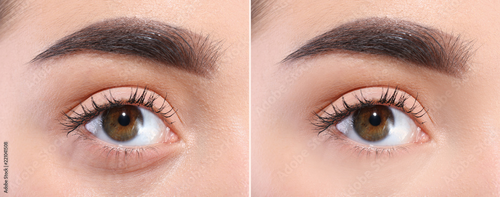 Obraz premium Young woman before and after cosmetic surgery operation, closeup