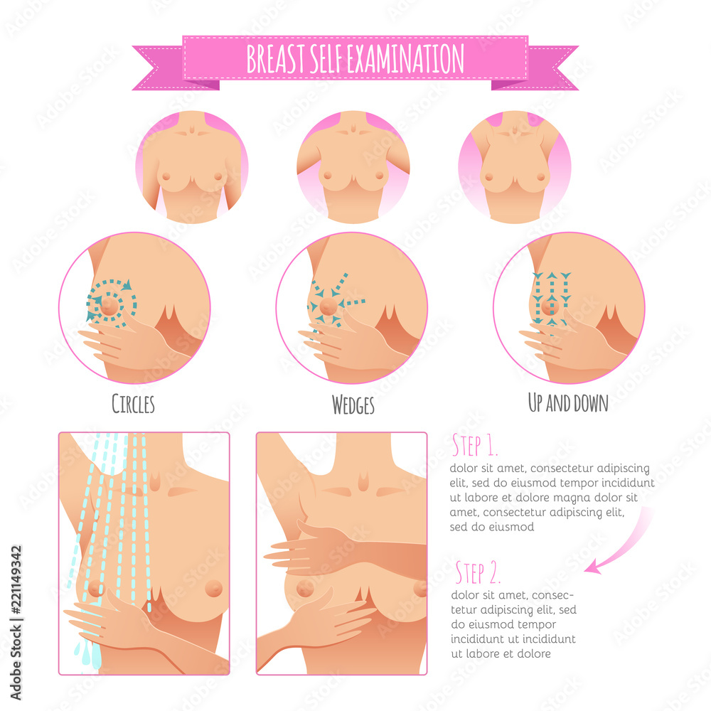 Breast cancer awareness infographic Breast cancer awareness infographic
