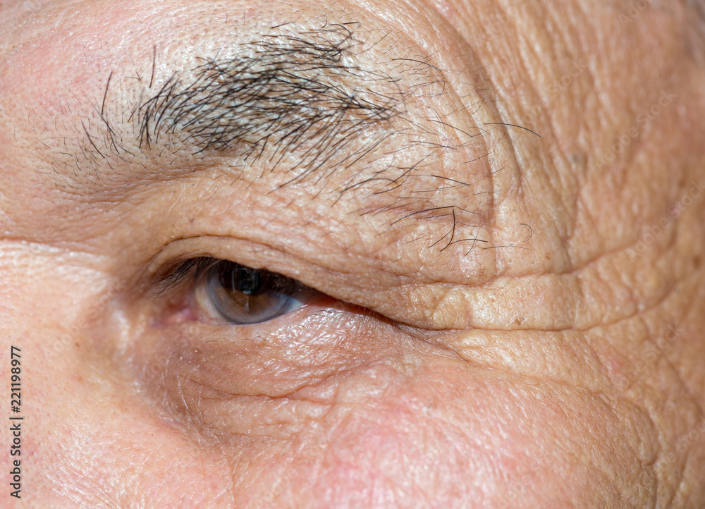 eye of an elderly man eye of an elderly man