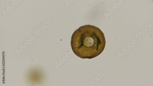 testate amoeba Arcella under the microscope photo