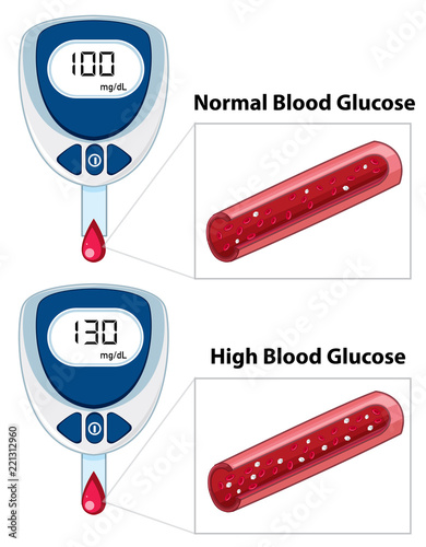 Medical blood glucose measurement
