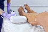 Epilation with a diode laser, hair removal with laser