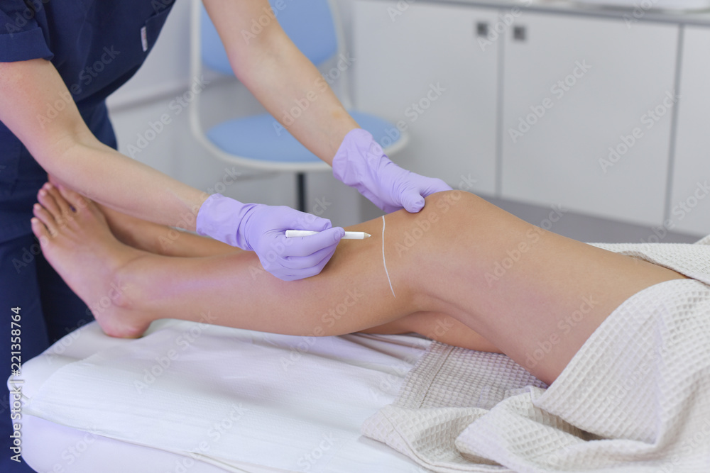 Naklejka premium Preparation for laser hair removal