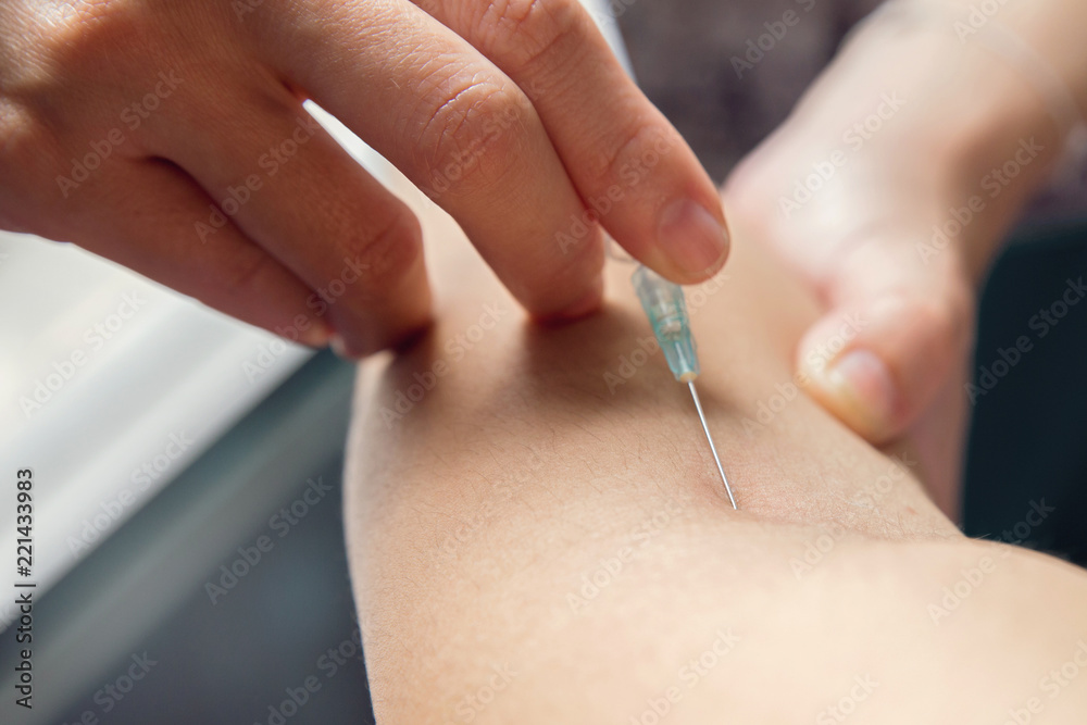 Close up pricking needle syringe in the arm patient blood sample for blood test Close up pricking needle syringe in the arm patient blood sample for blood test
