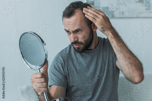 Bild auf Leinwand bearded middle aged man with alopecia looking at mirror, hair loss concept
