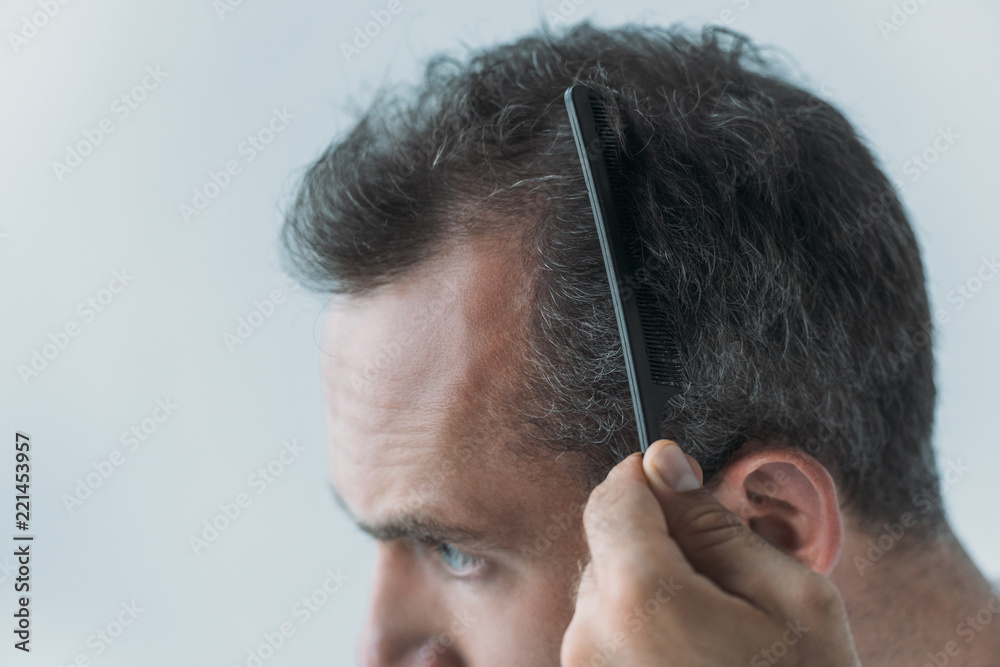 close-up view of mid adult man combing hair with comb isolated on grey, hair  loss concept Stock Photo | Adobe Stock