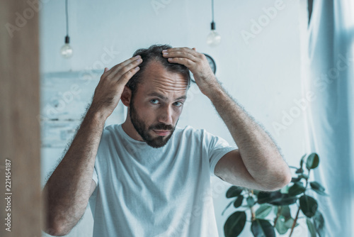 mid adult man with alopecia looking at mirror, hair loss concept photo