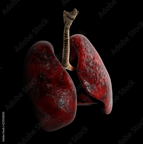 Human Lung anatomy, 3d Illustration on black background photo