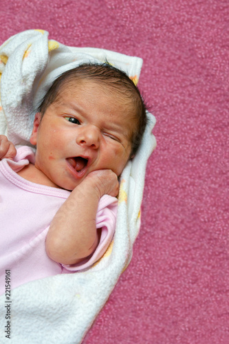 Jaundice Newborn Baby Laying On Back Exhibiting Rooting Reflex As Her Hand Touches Her Face